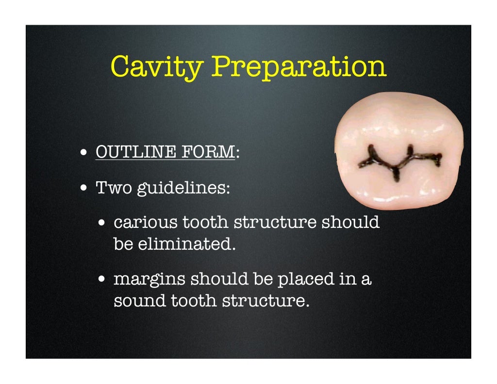 amalgam cavity preparation class i