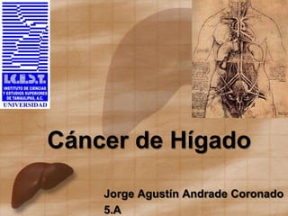 Cáncer de Hígado
Jorge Agustín Andrade Coronado
5.A
 