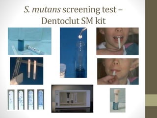 S. mutans screening test –
Dentoclut SM kit
 