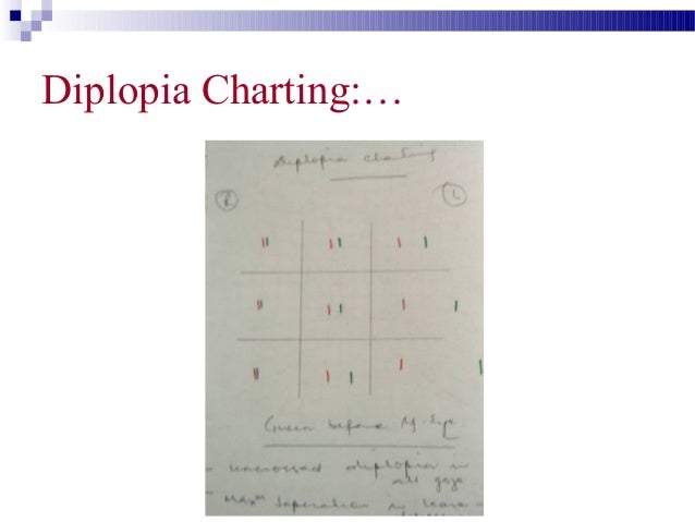 Normal Diplopia Chart