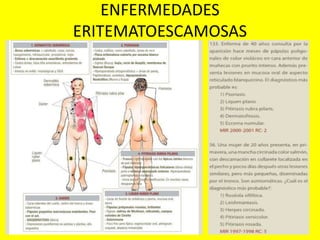 ENFERMEDADES
ERITEMATOESCAMOSAS
 