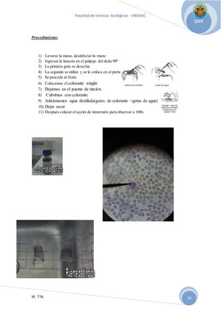 Facultad de ciencias biológicas - UNSAAC 
W. T.N. 
2008 
24 
Procedimiento: 
1) Lavarse la mano, desinfectar la mano 
2) Ingresar la lanceta en el pulpejo del dedo 90º 
3) La primera gota se desecha 
4) La segunda se utiliza y se le coloca en el porta 
5) Se procede al frotis 
6) Colocamos el colorante winghr 
7) Dejamos en el puente de tinción. 
8) Cubrimos con colorante 
9) Adicionamos agua destilada(gotas de colorante =gotas de agua) 
10) Dejar secar 
11) Después colocar el aceite de inmersión para observar a 100x 
 
 