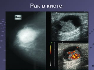 РРаакк вв ккииссттее 
 
