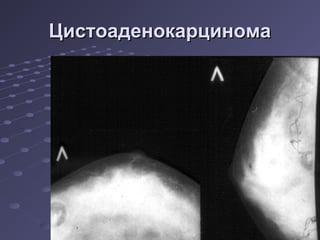 ЦЦииссттооааддееннооккааррццииннооммаа 
 