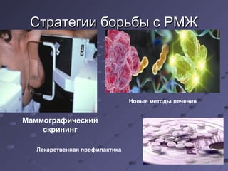 ССттррааттееггииии ббооррььббыы сс РРММЖЖ 
Маммографический 
скрининг 
Новые методы лечения 
Лекарственная профилактика 
 