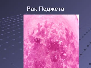 РРаакк ППеедджжееттаа 
 