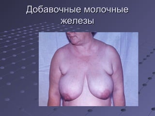 ДДооббааввооччнныыее ммооллооччнныыее 
жжееллееззыы 
 