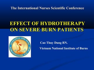 The International NNuurrsseess SScciieennttiiffiicc CCoonnffeerreennccee 
EEFFFFEECCTT OOFF HHYYDDRROOTTHHEERRAAPPYY 
OONN SSEEVVEERREE BBUURRNN PPAATTIIEENNTTSS 
Cao Thuy Dung RN. 
Vietnam National Institute of Burns 
 