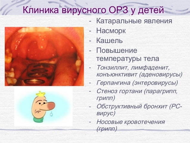 Оки вирусной этиологии