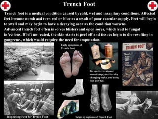 Trench Warfare Diagram
 