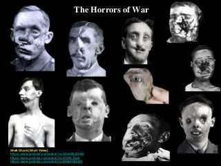 The Horrors of War
Shell Shock [Short Video]
https://www.youtube.com/watch?v=SS1dO0JC2EE
https://www.youtube.com/watch?v=S7Jll9_EiyA
https://www.youtube.com/watch?v=IWHbF5jGJY0
 