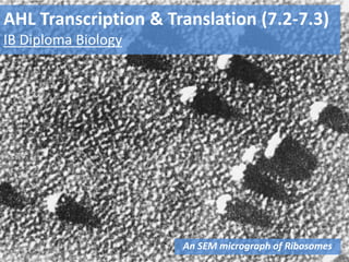 AHL Transcription & Translation (7.2-7.3)
IB Diploma Biology
An SEM micrograph of Ribosomes
 