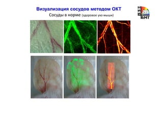 Визуализация сосудов методом ОКТ
Сосуды в норме (здоровое ухо мыши)
 
