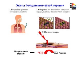 1. Введение в организм
фотосенсебилизатора
Этапы Фотодинамической терапии
2. Избирательное накопление в опухоли:
сосудах, клетках, межклеточном веществе
О2*О2 Переход
Повреждение
опухоли
3. Облучение лазером
 