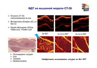 ФДТ на мышиной модели CT-26
Опухоль CT-26
локализованная на ухе
Фотодитазин (Хлорин e6), в.в.
5мг/кг
Режим облучения: 662нм,
75Дж/см2, 170мВт/cм2
До ФДТ 1д после ФДТ 2д после ФДТ
Полнокровие сосудов
Стаз
Тромбоз
Кровоизлияние
Необратимое исчезновение сосудов на МА ОКТ
50µm
 