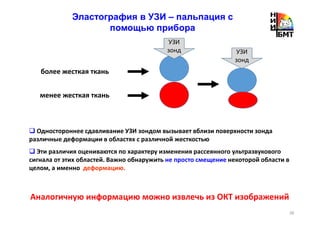 38
более жесткая ткань
менее жесткая ткань
Одностороннее сдавливание УЗИ зондом вызывает вблизи поверхности зонда
различные деформации в областях с различной жесткостью
Эти различия оцениваются по характеру изменения рассеянного ультразвукового
сигнала от этих областей. Важно обнаружить не просто смещение некоторой области в
целом, а именно деформацию.
Аналогичную информацию можно извлечь из ОКТ изображений
Эластография в УЗИ – пальпация с
помощью прибора
УЗИ
зонд УЗИ
зонд
 