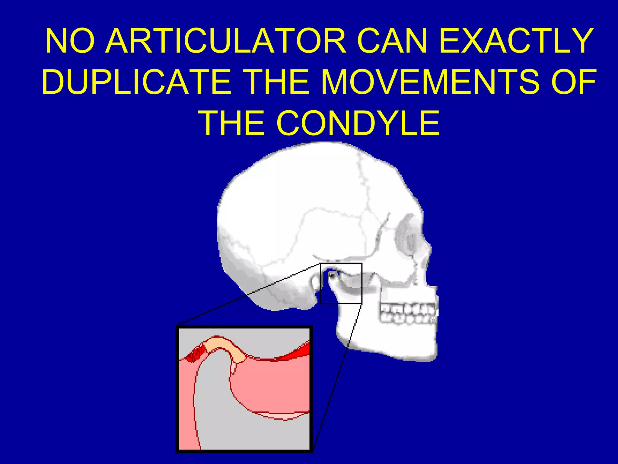 NO ARTICULATOR CAN EXACTLY
DUPLICATE THE MOVEMENTS OF
THE CONDYLE
 