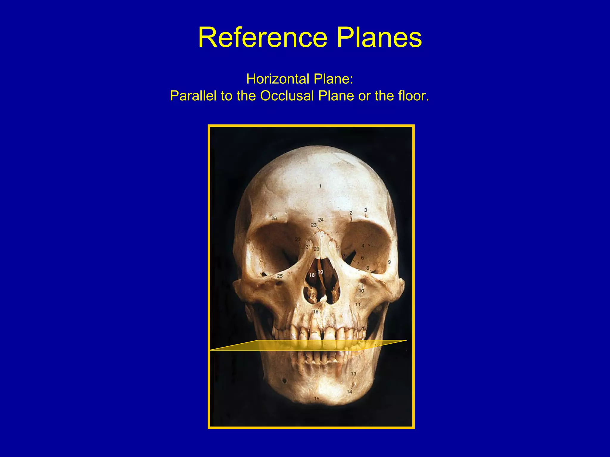 Reference Planes
Horizontal Plane:
Parallel to the Occlusal Plane or the floor.
 