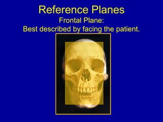 Reference Planes
Frontal Plane:
Best described by facing the patient.
 