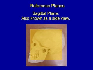 Reference Planes
Sagittal Plane:
Also known as a side view.
 