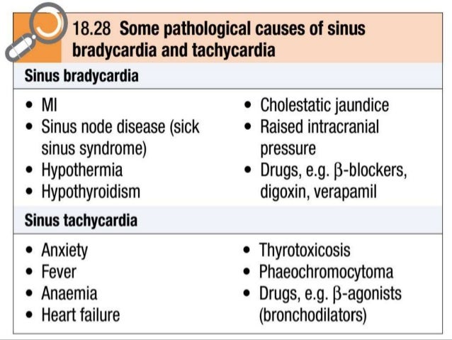 7 Disorders Of Heart Rate Rhythm