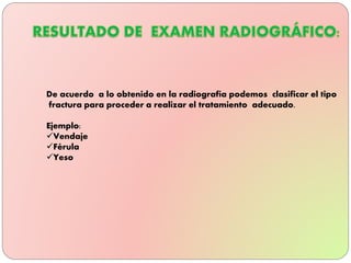 De acuerdo a lo obtenido en la radiografía podemos clasificar el tipo
fractura para proceder a realizar el tratamiento adecuado.
Ejemplo:
Vendaje
Férula
Yeso
 