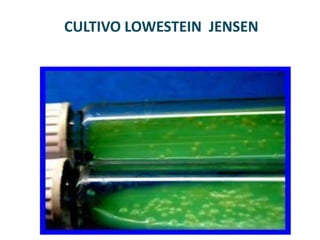 CULTIVO LOWESTEIN JENSEN
 