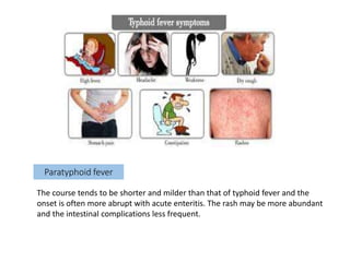 Paratyphoid fever
The course tends to be shorter and milder than that of typhoid fever and the
onset is often more abrupt with acute enteritis. The rash may be more abundant
and the intestinal complications less frequent.
 