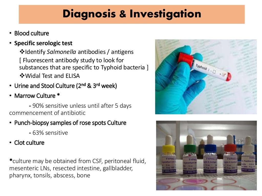 Enteric fever (typhoid fever)
