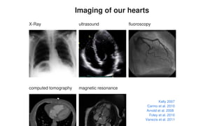 Imaging	of	our	hearts
X-Ray ultrasound fluoroscopy
computed	tomography magnetic	resonance
	
Kelly	2007
Carmo	et	al.	2010
Arnold	et	al.	2008
Foley	et	al.	2010
Vanezis	et	al.	2011
 