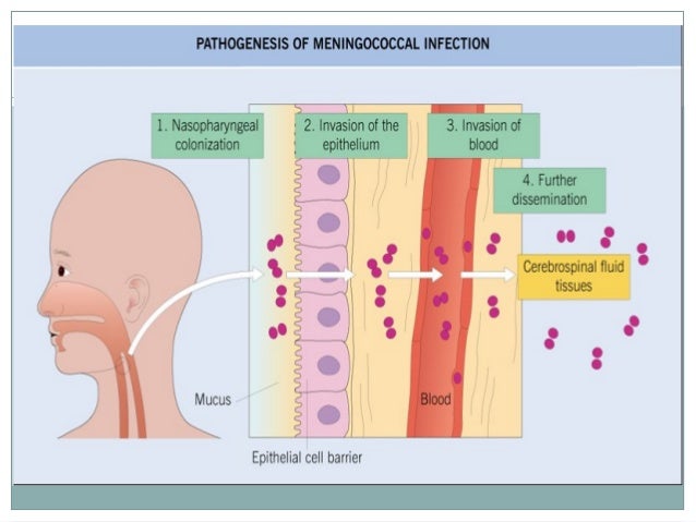 MENINGOCOCCAL INFECTION PDF MENINGOCOCCAL INFECTION PDF