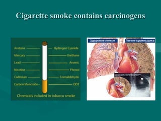 Cigarette smoke contains carcinogensCigarette smoke contains carcinogens
 