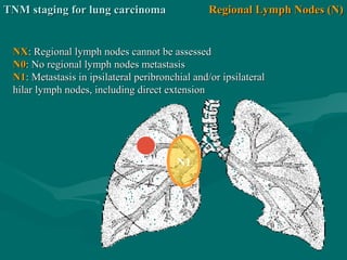 N1
Regional Lymph Nodes (N)Regional Lymph Nodes (N)
NXNX: Regional lymph nodes cannot be assessed: Regional lymph nodes cannot be assessed
N0N0: No regional lymph nodes metastasis: No regional lymph nodes metastasis
N1N1: Metastasis in ipsilateral peribronchial and/or ipsilateral: Metastasis in ipsilateral peribronchial and/or ipsilateral
hilar lymph nodes, including direct extensionhilar lymph nodes, including direct extension
TNM staging for lung carcinomaTNM staging for lung carcinoma
 