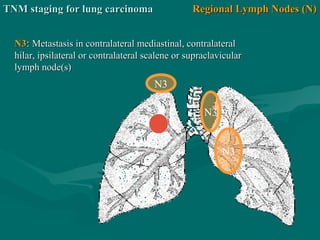 N3
N3
N3
N3N3:: Metastasis in contralateral mediastinal, contralateralMetastasis in contralateral mediastinal, contralateral
hilar, ipsilateral or contralateral scalene or supraclavicularhilar, ipsilateral or contralateral scalene or supraclavicular
lymph node(s)lymph node(s)
Regional Lymph Nodes (N)Regional Lymph Nodes (N)TNM staging for lung carcinomaTNM staging for lung carcinoma
 