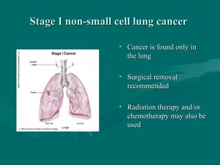 Stage I non-small cell lung cancerStage I non-small cell lung cancer
• Cancer is found only inCancer is found only in
the lungthe lung
• Surgical removalSurgical removal
recommendedrecommended
• Radiation therapy and/orRadiation therapy and/or
chemotherapy may also bechemotherapy may also be
usedused
 