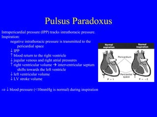 Pulsus Paradoxus
Intrapericardial pressure (IPP) tracks intrathoracic pressure.
Inspiration:
negative intrathoracic pressure is transmitted to the
pericardial space
↓ IPP
↑ blood return to the right ventricle
↓ jugular venous and right atrial pressures
↑ right ventricular volume  interventricular septum
shifts towards the left ventricle
↓ left ventricular volume
↓ LV stroke volume
⇒ ↓ blood pressure (<10mmHg is normal) during inspiration
 