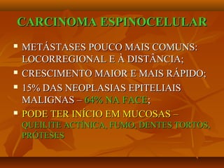 CARCINOMA ESPINOCELULARCARCINOMA ESPINOCELULAR
 METÁSTASES POUCO MAIS COMUNS:METÁSTASES POUCO MAIS COMUNS:
LOCORREGIONAL E À DISTÂNCIA;LOCORREGIONAL E À DISTÂNCIA;
 CRESCIMENTO MAIOR E MAIS RÁPIDO;CRESCIMENTO MAIOR E MAIS RÁPIDO;
 15% DAS NEOPLASIAS EPITELIAIS15% DAS NEOPLASIAS EPITELIAIS
MALIGNAS –MALIGNAS – 64% NA FACE64% NA FACE;;
 PODE TER INÍCIO EM MUCOSAS –PODE TER INÍCIO EM MUCOSAS –
QUEILITE ACTÍNICA, FUMO, DENTES TORTOS,QUEILITE ACTÍNICA, FUMO, DENTES TORTOS,
PRÓTESESPRÓTESES
 