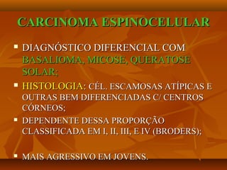 CARCINOMA ESPINOCELULARCARCINOMA ESPINOCELULAR
 DIAGNÓSTICO DIFERENCIAL COMDIAGNÓSTICO DIFERENCIAL COM
BASALIOMA, MICOSE, QUERATOSEBASALIOMA, MICOSE, QUERATOSE
SOLAR;SOLAR;
 HISTOLOGIAHISTOLOGIA:: CÉL. ESCAMOSAS ATÍPICAS ECÉL. ESCAMOSAS ATÍPICAS E
OUTRAS BEM DIFERENCIADAS C/ CENTROSOUTRAS BEM DIFERENCIADAS C/ CENTROS
CÓRNEOS;CÓRNEOS;
 DEPENDENTE DESSA PROPORÇÃODEPENDENTE DESSA PROPORÇÃO
CLASSIFICADA EM I, II, III, E IV (BRODERS);CLASSIFICADA EM I, II, III, E IV (BRODERS);
 MAIS AGRESSIVO EM JOVENS.MAIS AGRESSIVO EM JOVENS.
 