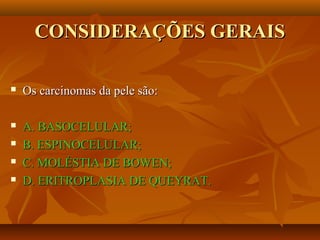 CONSIDERAÇÕES GERAISCONSIDERAÇÕES GERAIS
 Os carcinomas da pele são:Os carcinomas da pele são:
 A. BASOCELULAR;A. BASOCELULAR;
 B. ESPINOCELULAR;B. ESPINOCELULAR;
 C. MOLÉSTIA DE BOWEN;C. MOLÉSTIA DE BOWEN;
 D. ERITROPLASIA DE QUEYRAT.D. ERITROPLASIA DE QUEYRAT.
 