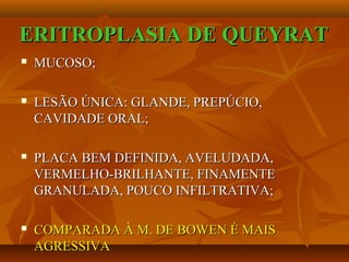 ERITROPLASIA DE QUEYRATERITROPLASIA DE QUEYRAT
 MUCOSO;MUCOSO;
 LESÃO ÚNICA: GLANDE, PREPÚCIO,LESÃO ÚNICA: GLANDE, PREPÚCIO,
CAVIDADE ORAL;CAVIDADE ORAL;
 PLACA BEM DEFINIDA, AVELUDADA,PLACA BEM DEFINIDA, AVELUDADA,
VERMELHO-BRILHANTE, FINAMENTEVERMELHO-BRILHANTE, FINAMENTE
GRANULADA, POUCO INFILTRATIVA;GRANULADA, POUCO INFILTRATIVA;
 COMPARADA À M. DE BOWEN É MAISCOMPARADA À M. DE BOWEN É MAIS
AGRESSIVAAGRESSIVA
 