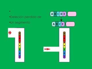 ●
●
Deleción perdida de
●
Un segmento
 
