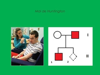 Mal de Huntington
 