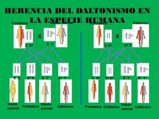 HERENCIA DEL DALTONISMO EN
LA ESPECIE HUMANA DaltónicoPortadora
Visión
normal
X X
X XdX Xd X Y Xd Y
X X Xd X X Xd Xd XdX Y Xd Y X Y Xd Y
Visión normal Portadora
Portadora Portadora
Visión
normal
Daltónico
Visión
normal
DaltónicoDaltónica
 