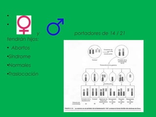 ●
●
y portadores de 14 / 21
tendrán hijos:
●
Abortos
●
Síndrome
●
Normales
●
Traslocación
 