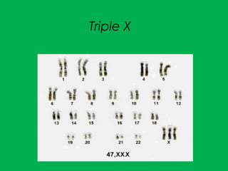 Triple X
 