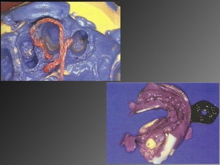 7.impression materials and techniques 2