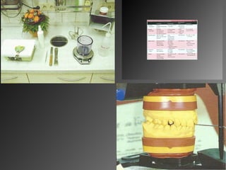 7.impression materials and techniques 2