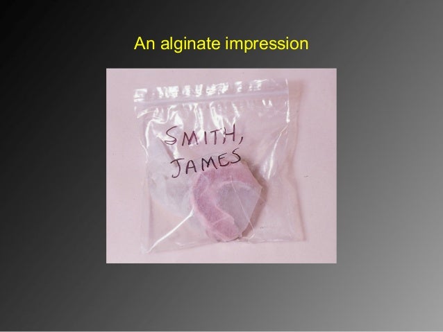 alginate impression making alginate impression making