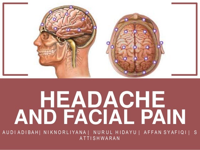 Headache Facial Pain Headache Facial Pain