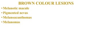 BROWN COLOUR LESIONS
•Melanotic macule
•Pigmented nevus
•Melanoacanthomas
•Melanomas
 